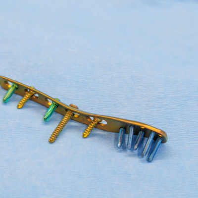 titanium surgical plate and titanium screws for the treatment of
